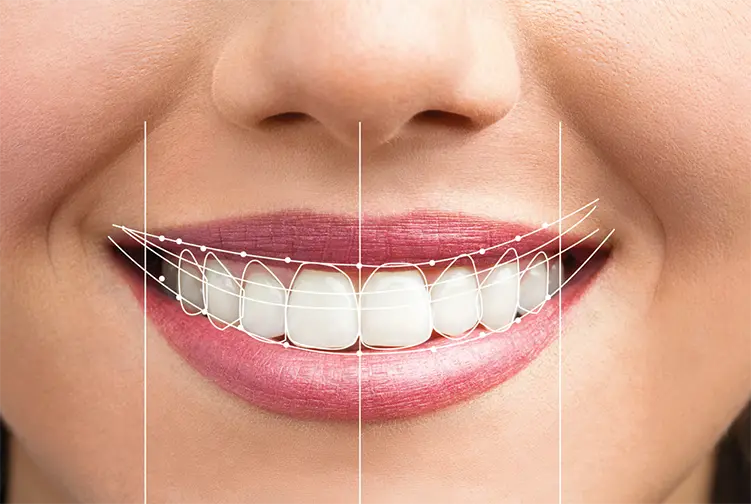 Designul Zâmbetului cu Dinti de Zirconiu