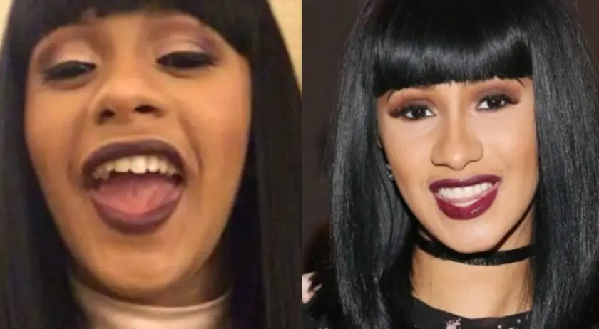 impianto dentale cardi b