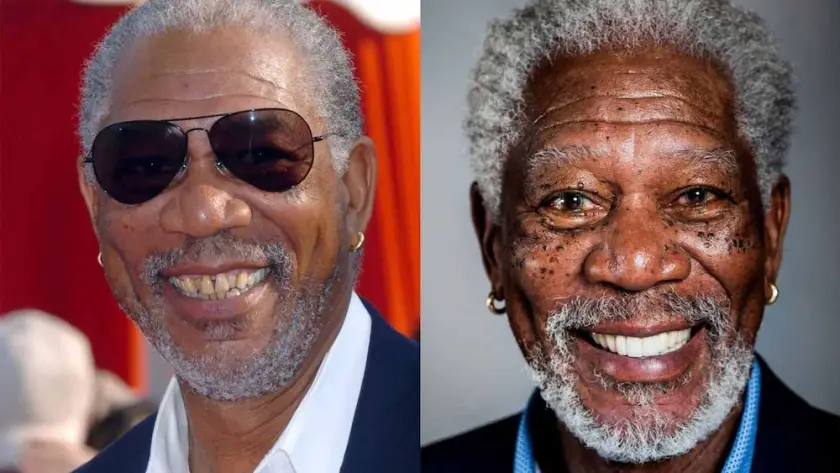 Impianto dentale di Morgan Freeman