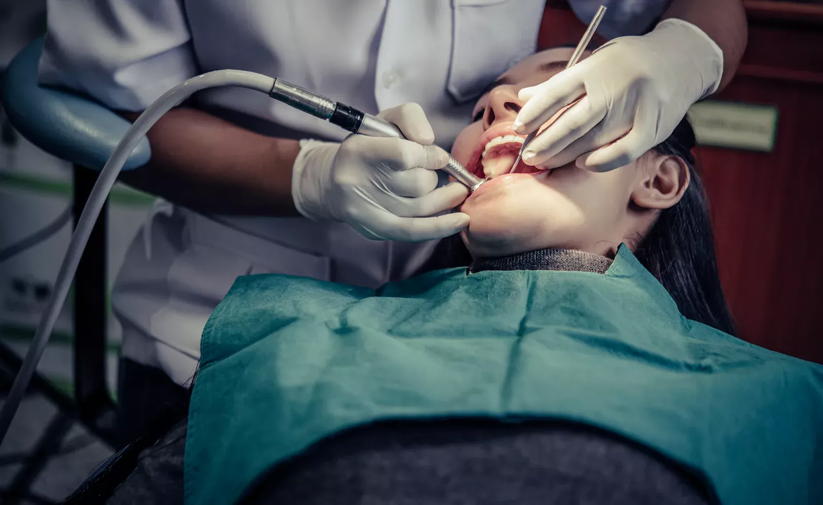 How Long Should You Use Gauze after Wisdom Teeth Removal?