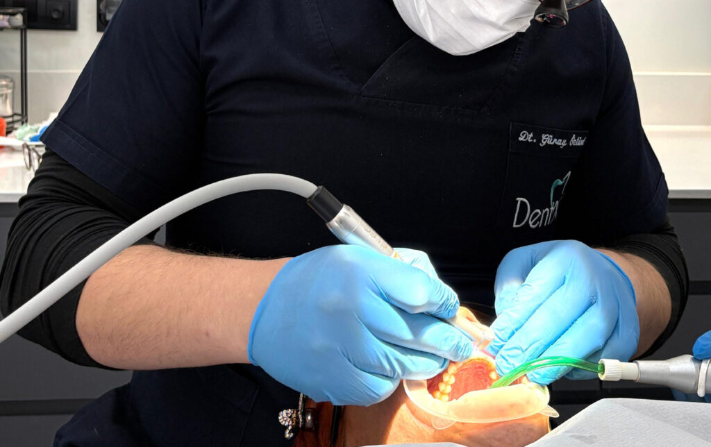 Dent X Total Care_Dent X Total Care,