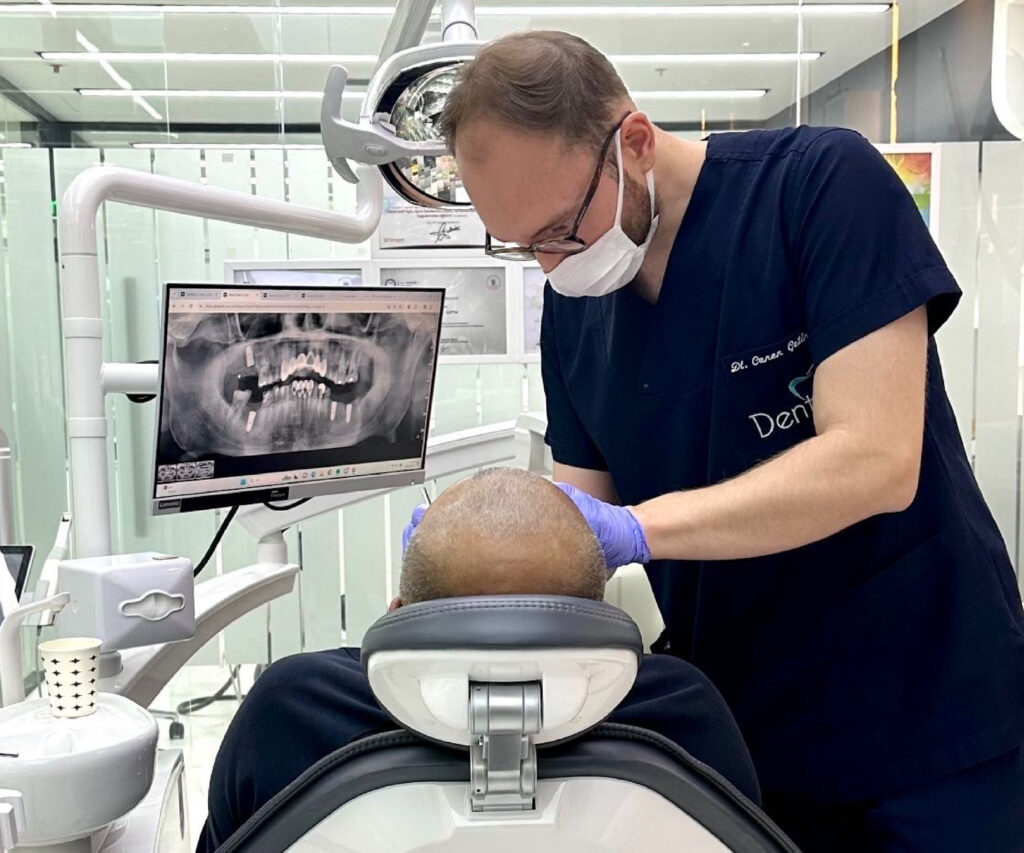 Dental Implant,_Dental Implant-04