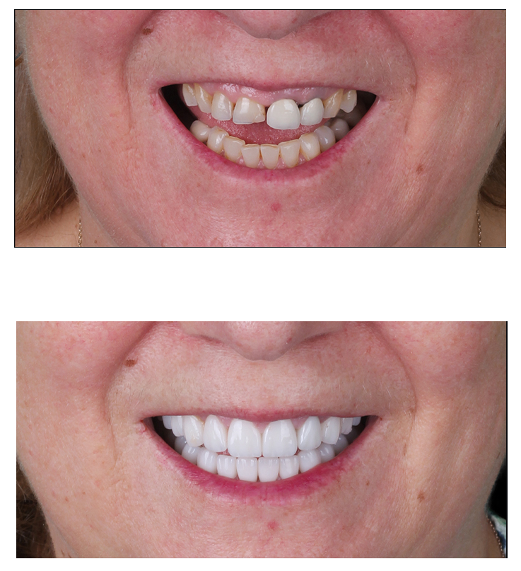 2- before afetr copy