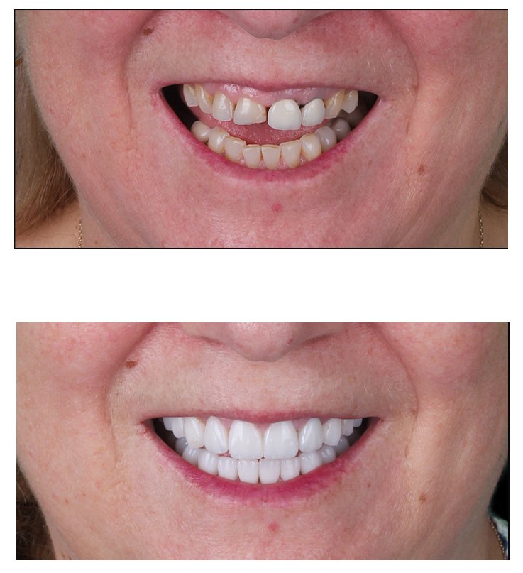 2- before afetr copy